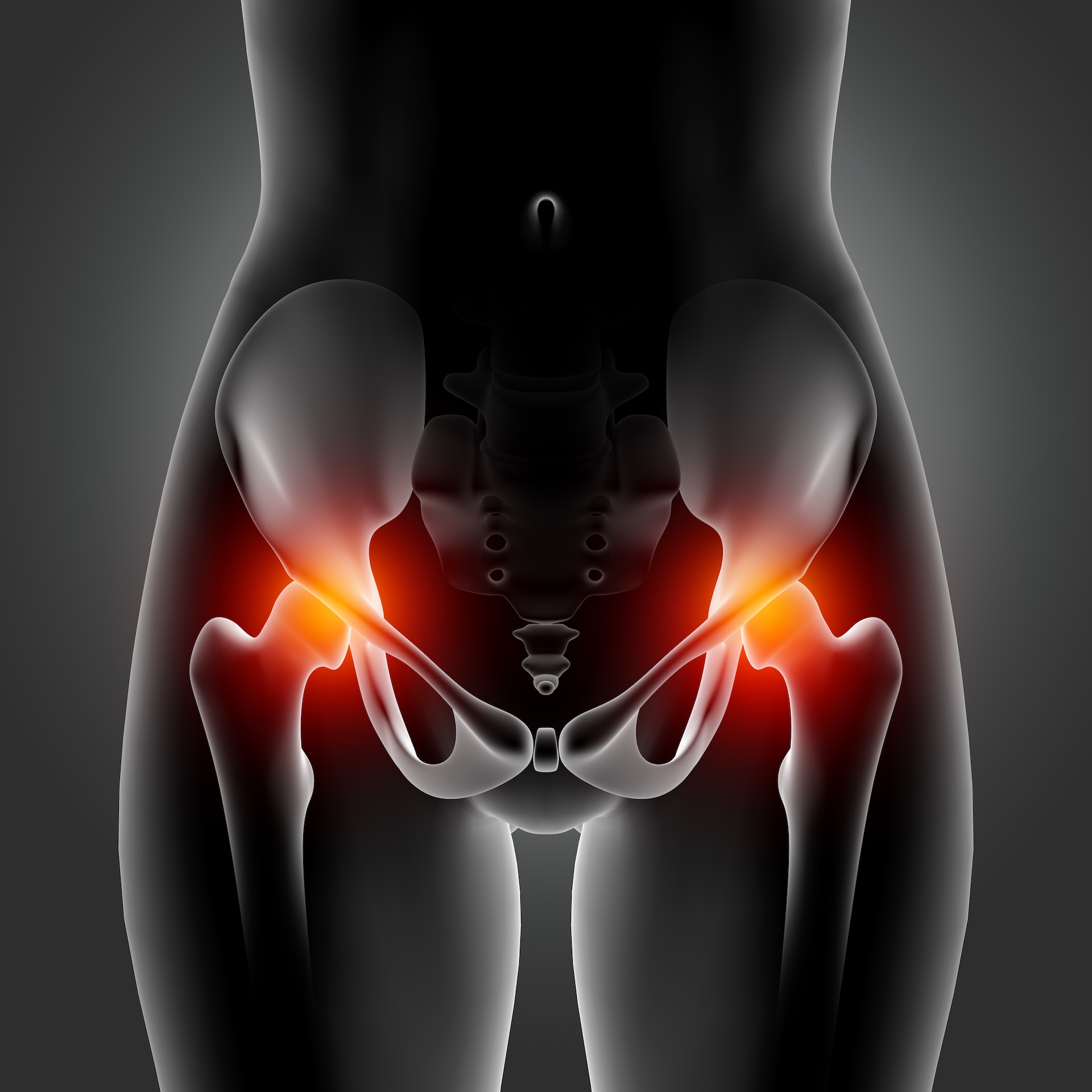 total hip arthroplasty